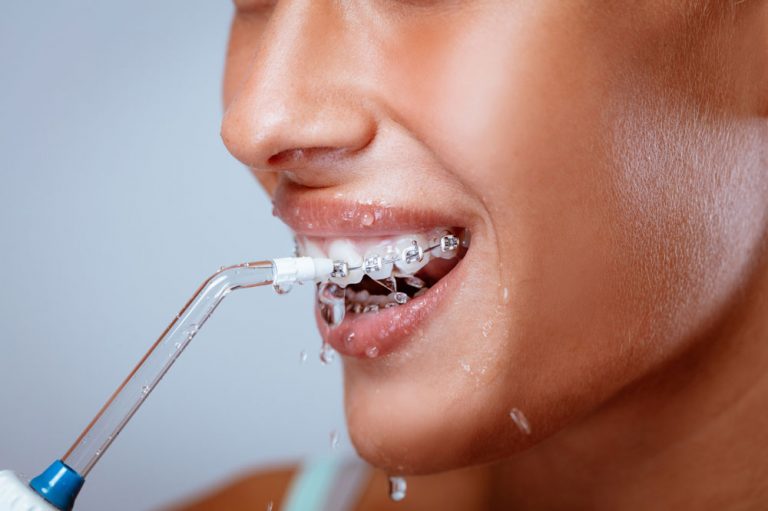 5 Alternatives To Flossing And Our Recommendations