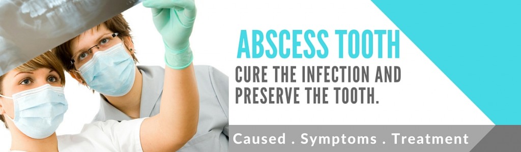 Abscess Tooth- Causes, Symptoms, Remedies, Treatment