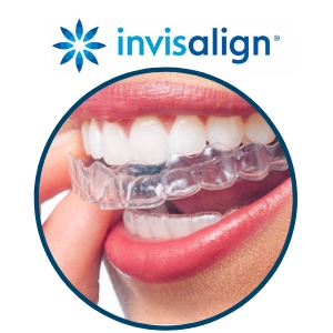 Best At Home Orthodontics | Alternatives to Invisalign