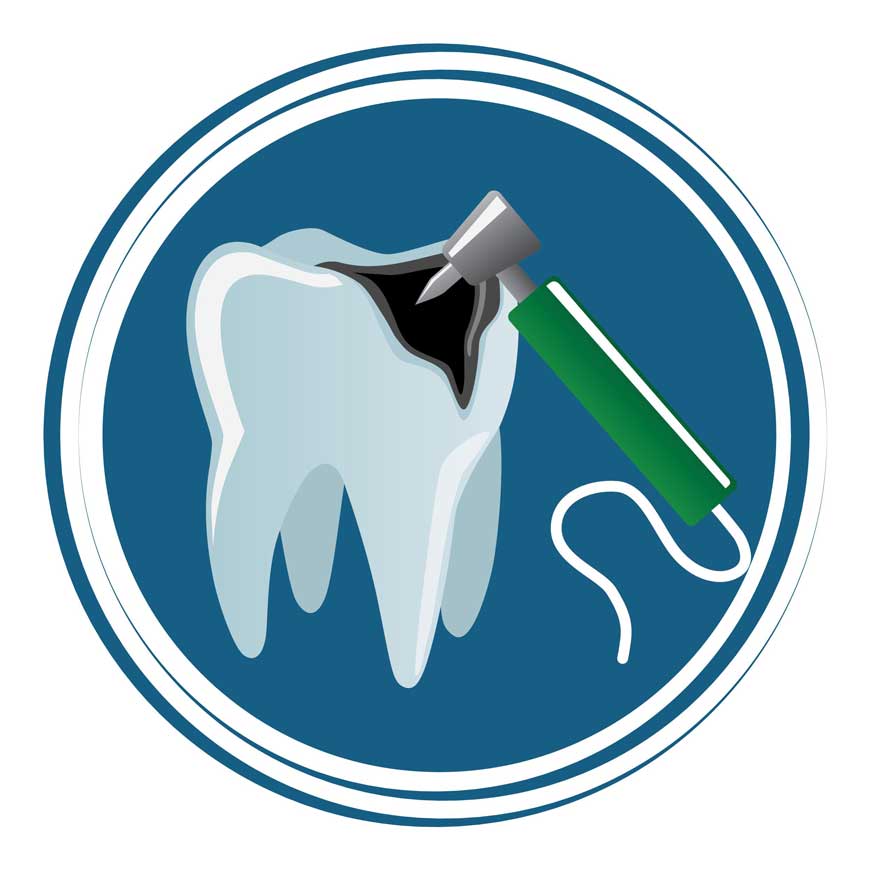 Tooth Root Canal Infection
